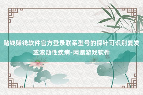 赌钱赚钱软件官方登录联系型号的探针可识别复发或滚动性疾病-网赌游戏软件